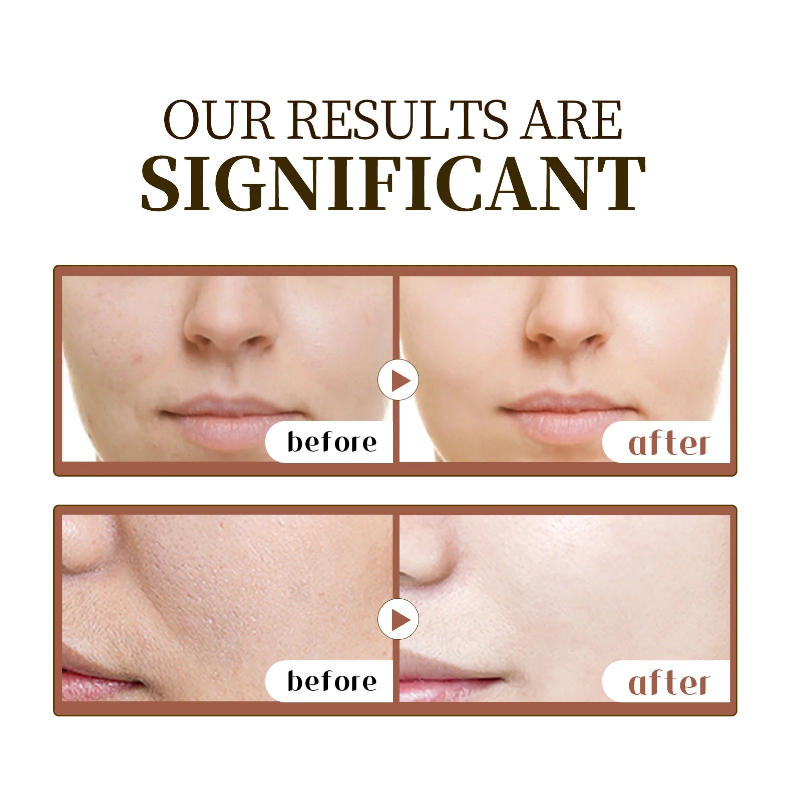 Madagascar Centella Asiatica Serum 55ml